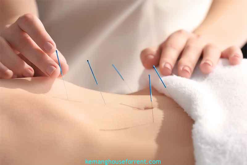 top 10 benefits of acupuncture